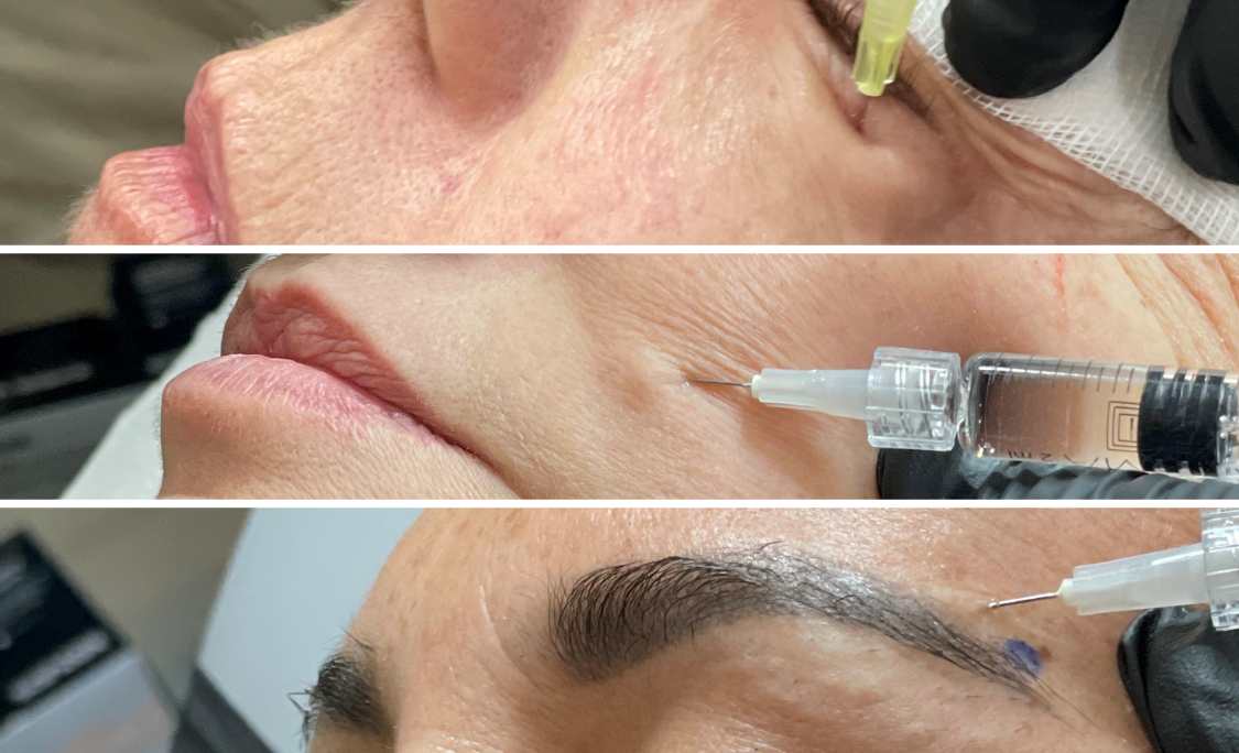 Tratamiento Medicina Estetica Clideba1