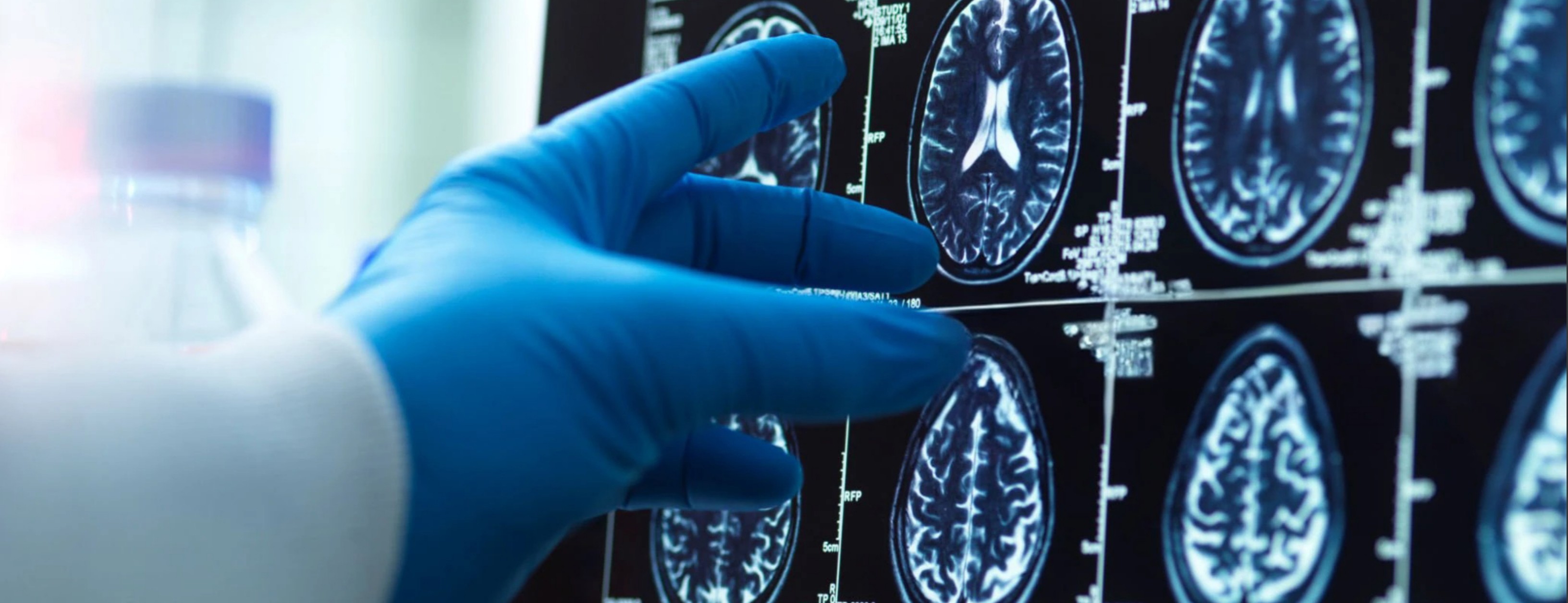 1170 Neurocirugía