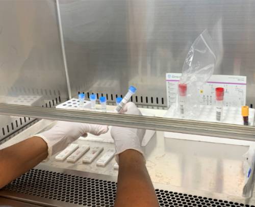test_antígenos_quironsalud_marbella