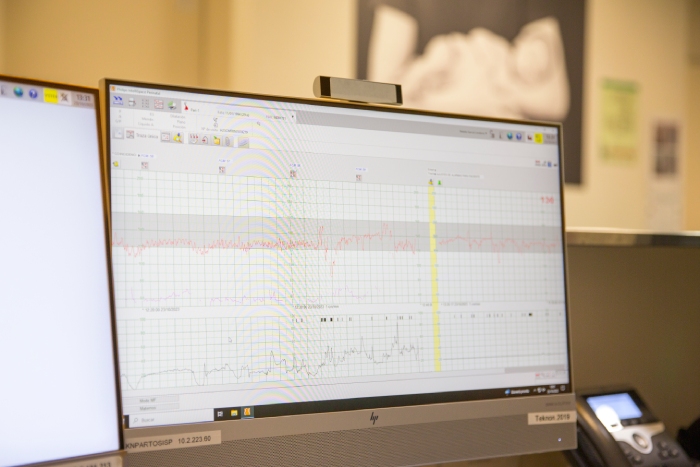 monitorizacion continua sala partos Teknon