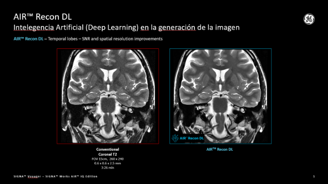 air recon dl inteligencia artificial