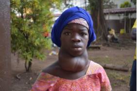 paciente tiroide sierra leona antes de ser operada