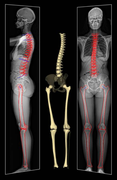 Cuerpo entero 2D y 3D