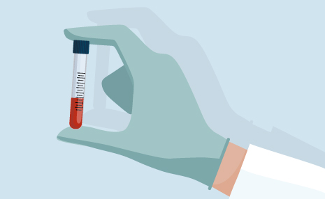 QS-T3-HQ-S-Coraz+¦n-Test-Anticuerpos-Destacado-465x286-Marz21