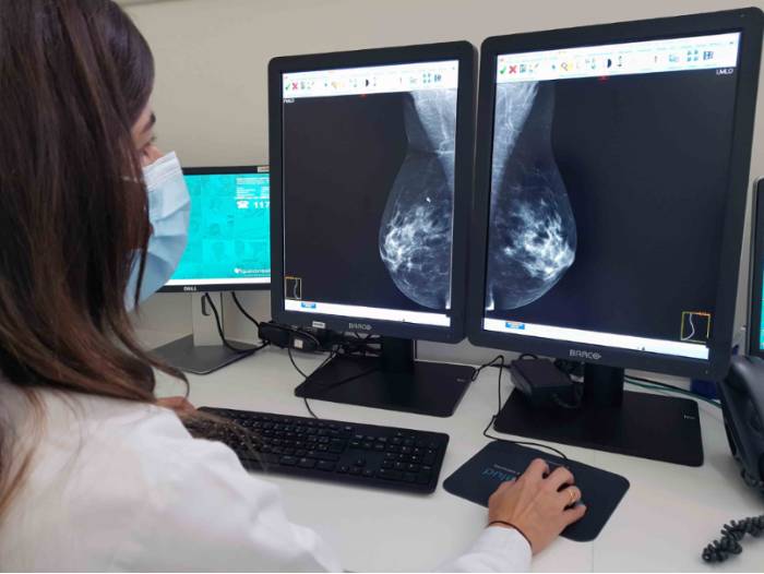 mamografia_marbella