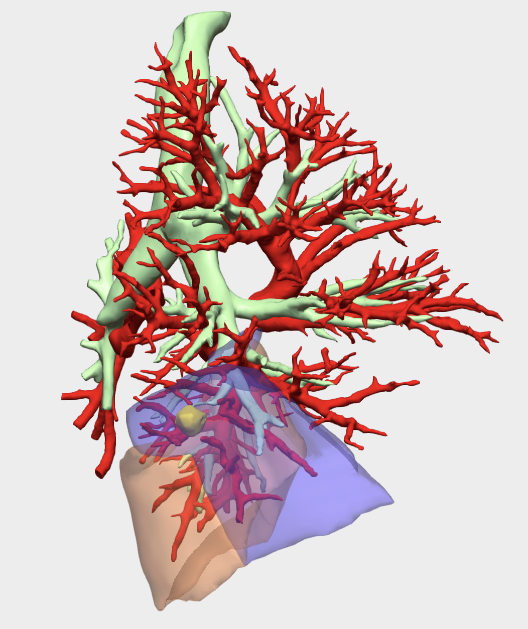 cirugía torácica 3D