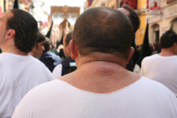 LESIÓN COSTALERO (Large) (Small)