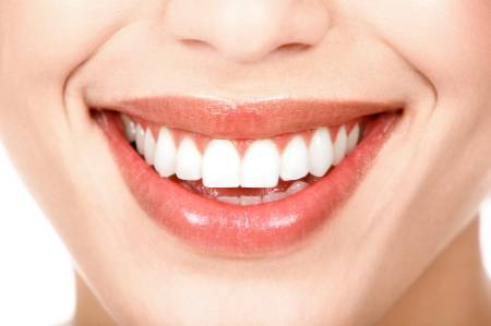 blanqueamiento dental referencia
