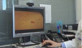 2019 02 20 Ejemplo de imagen enviada por teleconsulta 1