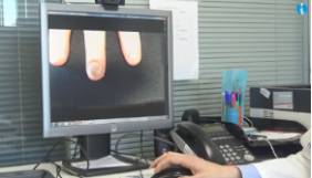 2019 02 20 Ejemplo de imagen enviada por teleconsulta 3