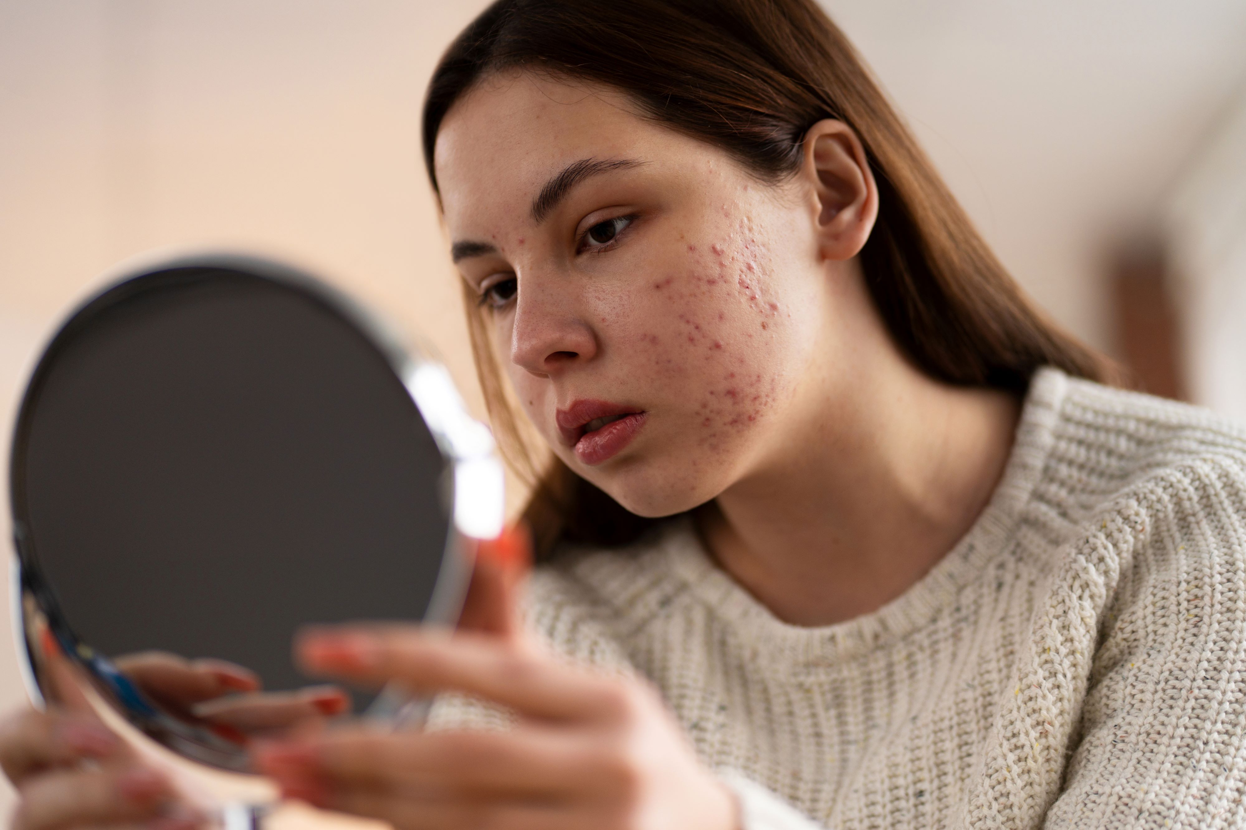 persona-que-trata-con-rosacea baja