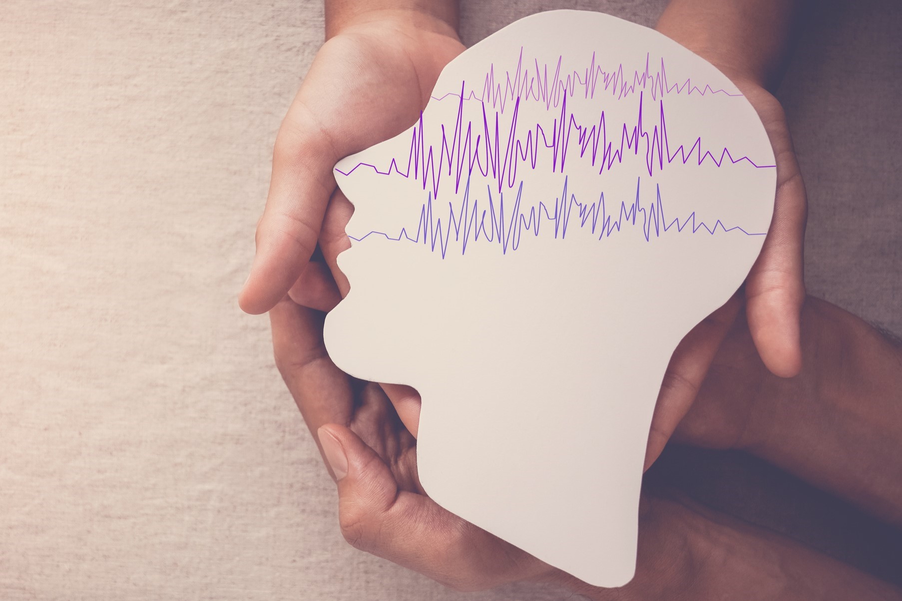 Epilepsia