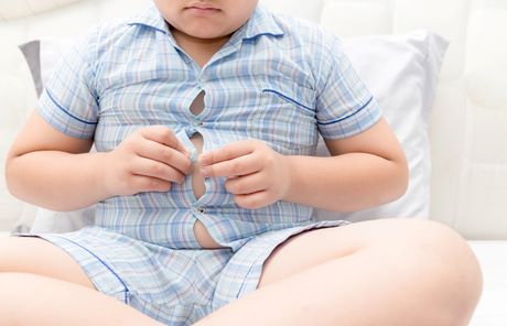 Obesidad Infantil