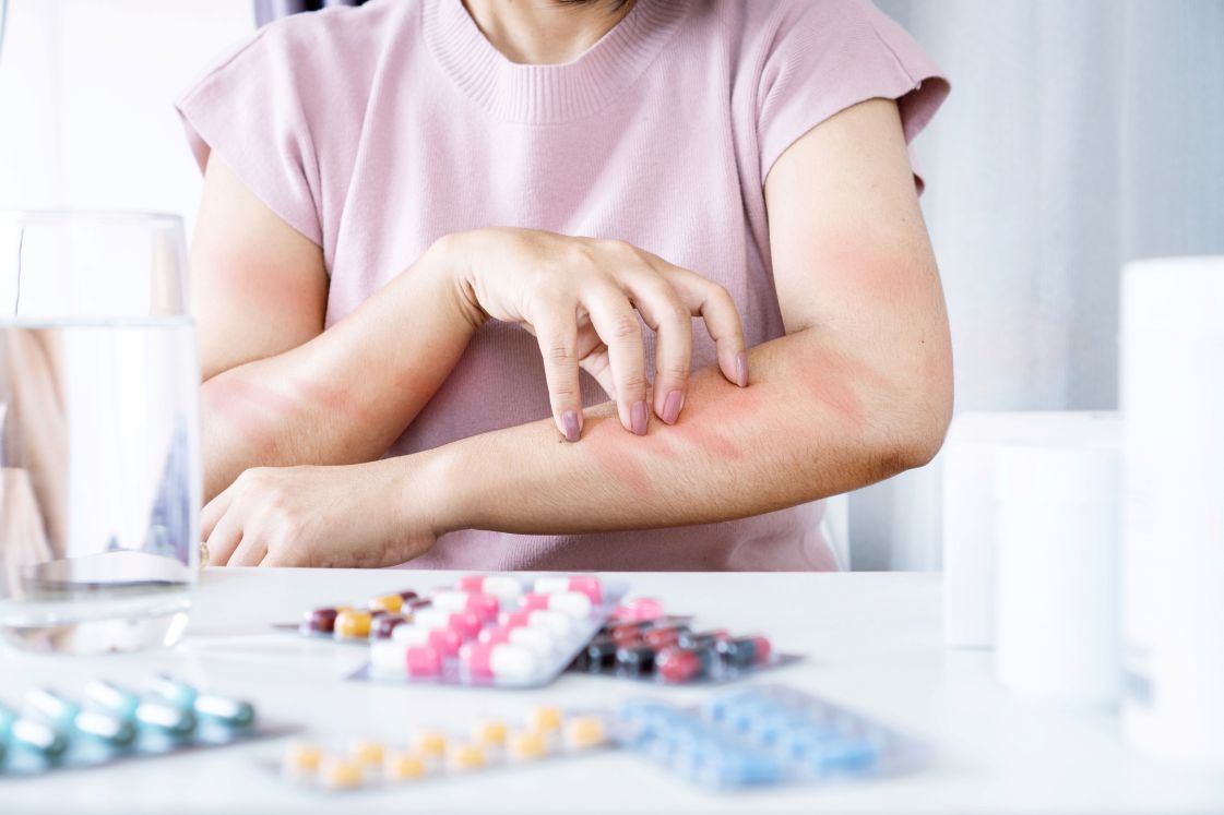 alergia_medicamentos_hospital_universitari_dexeus