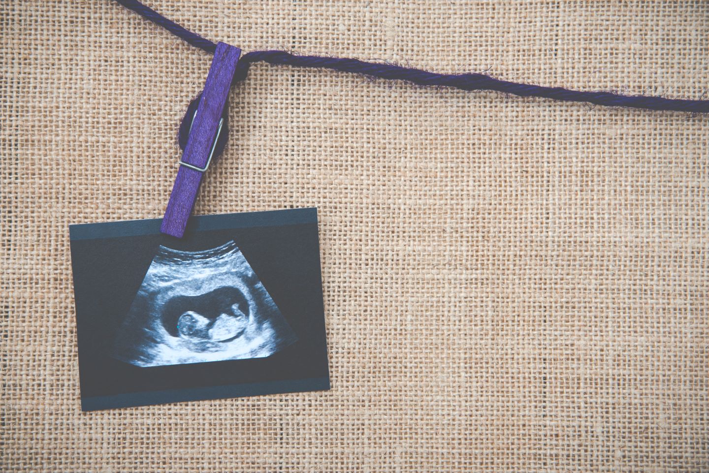 Aborto