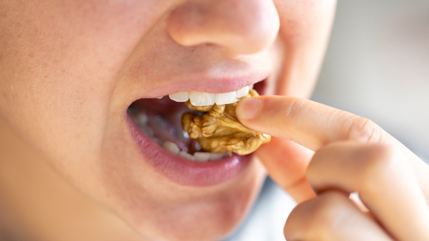 Rehabilitacion-neuro-oclusal