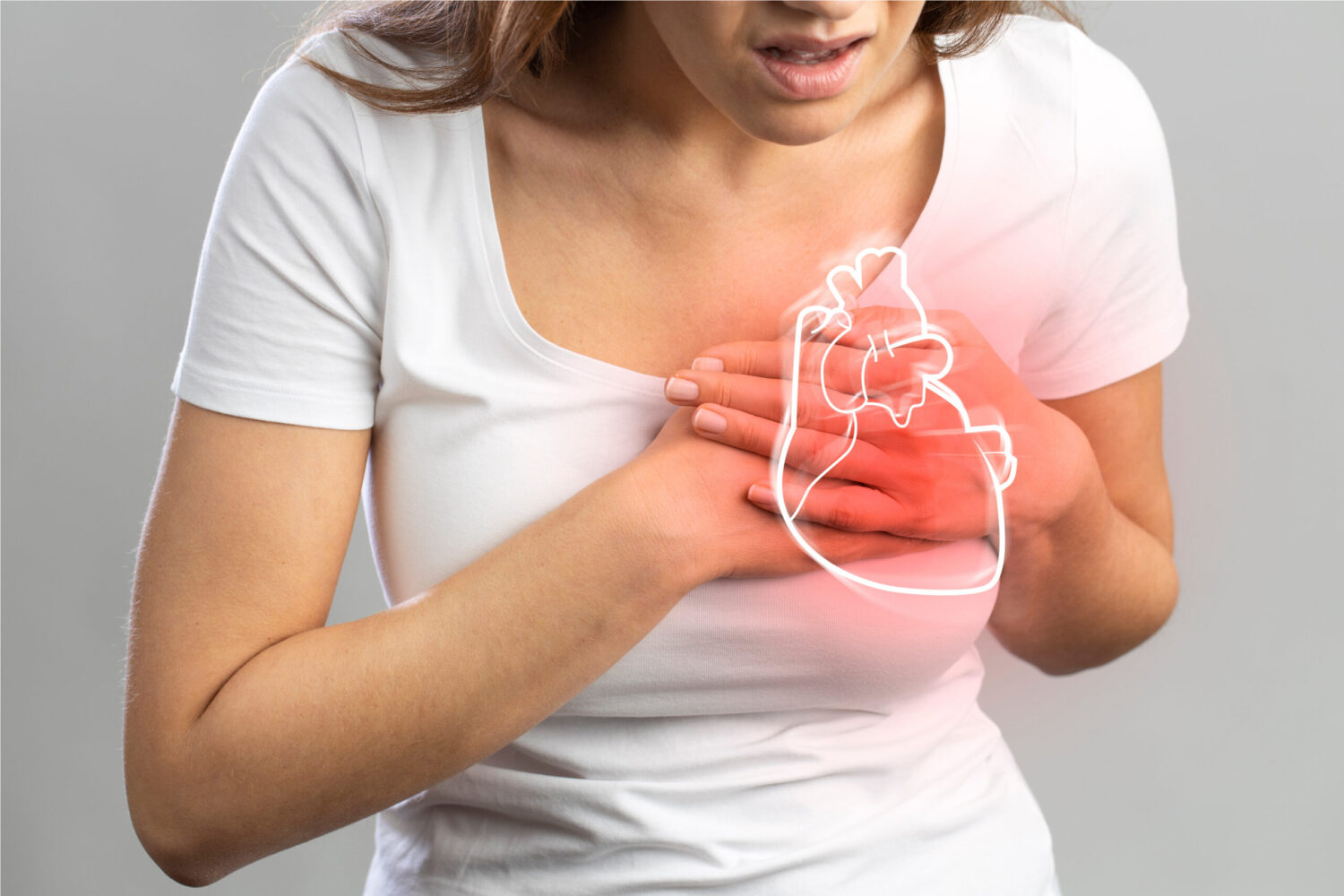 5.-infarto-femenino-1500x1000