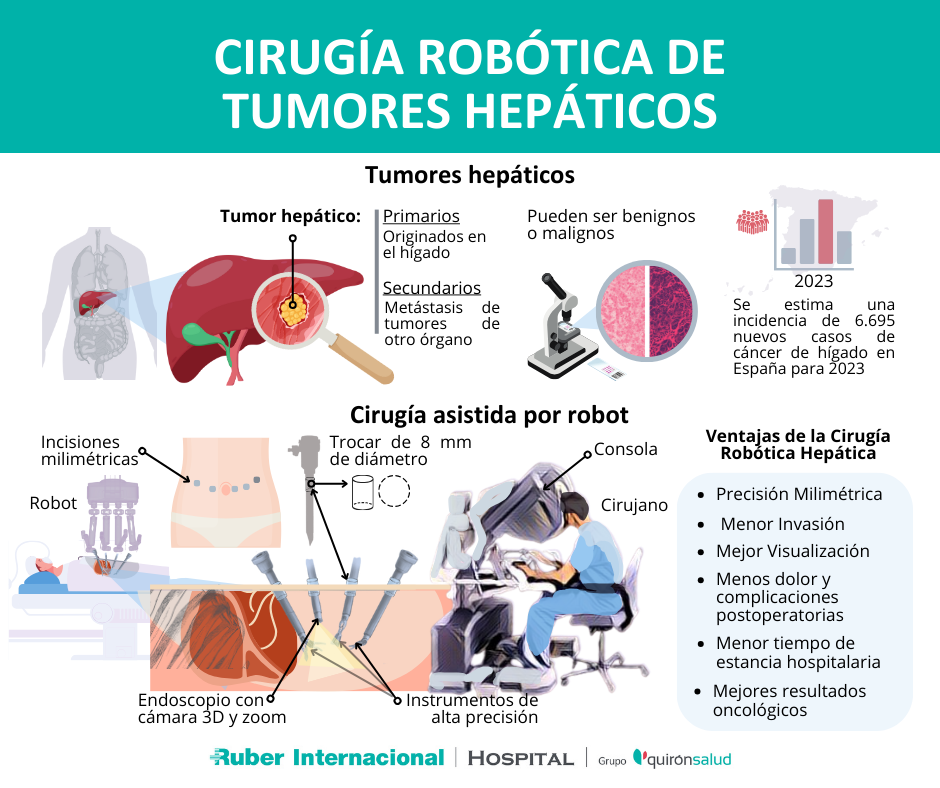 Cirugía Robótica de tumores hepáticos Ruber