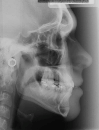 importancia-radiologia