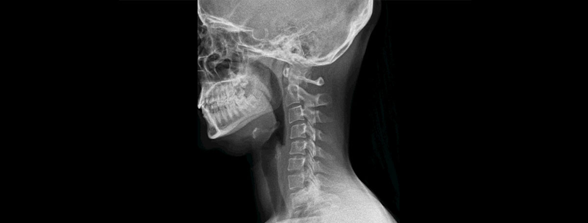 Radiología digital dinámica (DDR)