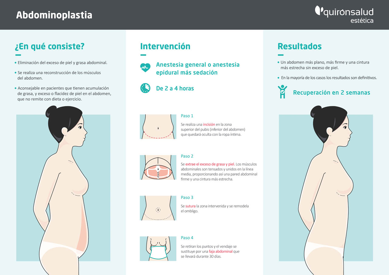 Infografía Abdominoplastia