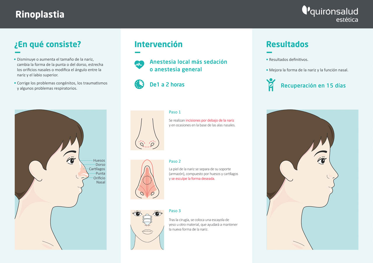 Infografía Rinoplastia