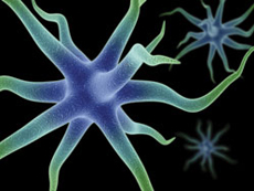 Neurocirugia