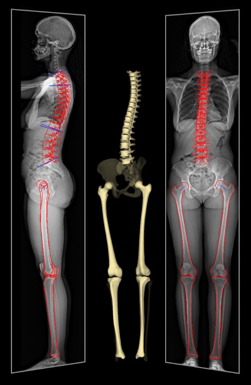 Cuerpo entero 2D y 3D