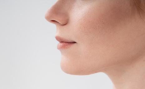 rinoplastia estetica aspectos a tener en cuenta