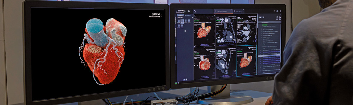 HQS BCN-Cabeceras CARDIOLOGIA web (1170x350p) 26my-4