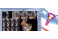 Planificación de implantes dentales