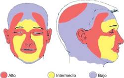 Localizaciones carcinoma basocelular - Cirugía Micrográfica de Mohs