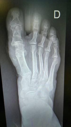 Después del procedimiento