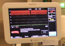 Pantalla de la guia de presion que mues tra la fase de calibración del di...