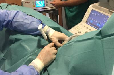 ablación por microondas