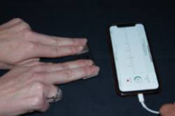 Durante un screening