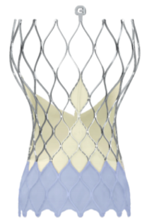 La válvula de última generación CoreValve EVOLUT R Pro ha demostrado elevadas tasas de supervivencia y de necesidad de implantar un marcapasos definitivo.