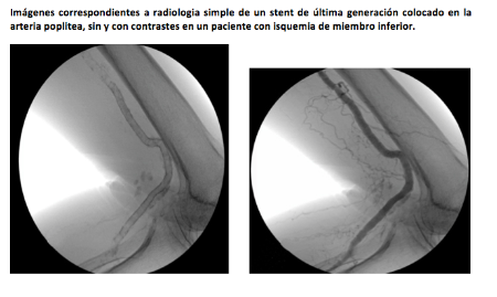 Captura de pantalla 2018-05-16 a las 14.21.21