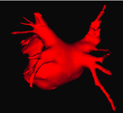 Imagen tridimensional de la aurícula izquierda