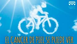 cancer de piel