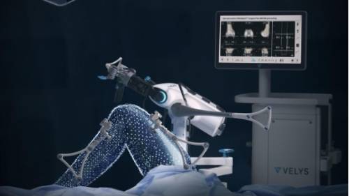 VELYS Robotic-Assisted Solution