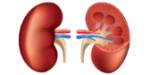 Insuficiencia renal