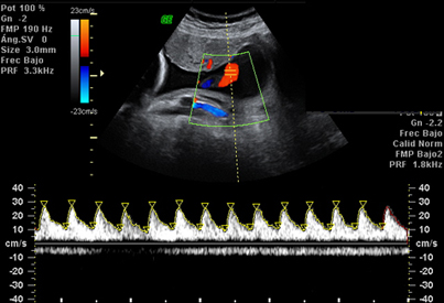 eco_doppler_tercer_trimestre