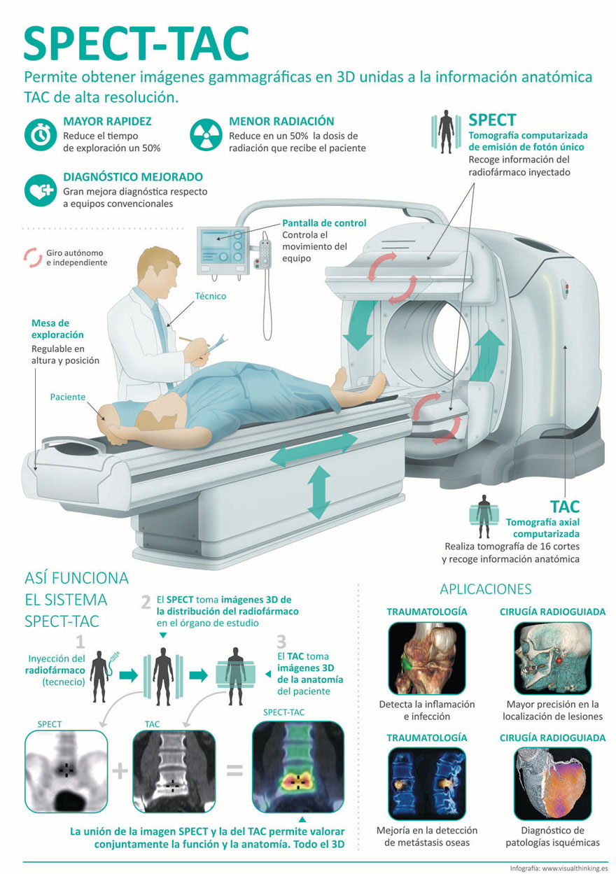 infografia_nuevo_spect_tac_quironsalud_madrid
