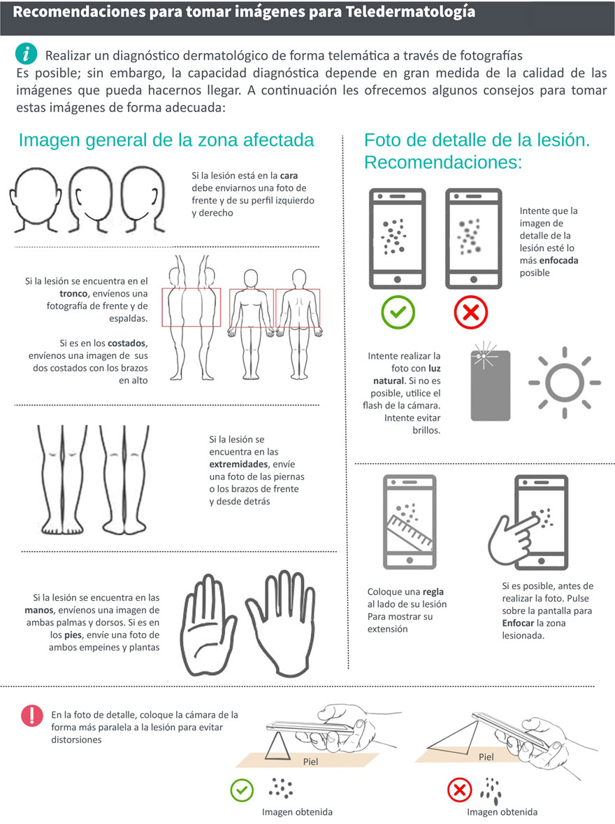 recomendaciones-imagenes-teledermatologia