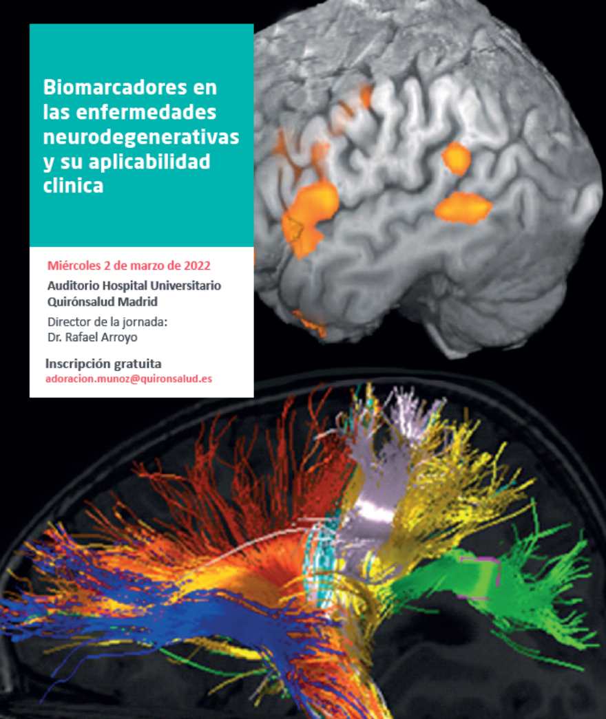 jornada_biomarcadores_enfermedades_neurodegenerativas