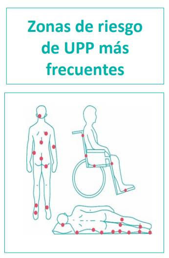 ulcera_presion_zonas_frecuentes