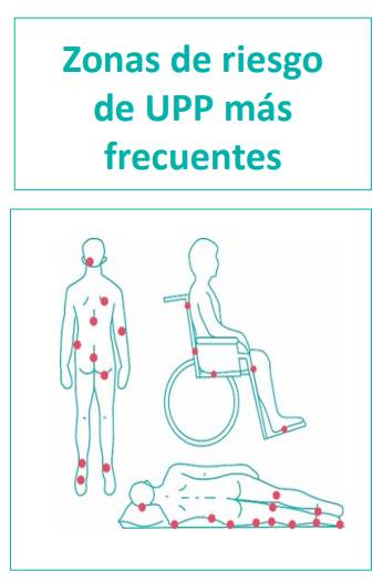 ulcera_presion_zonas_frecuentes