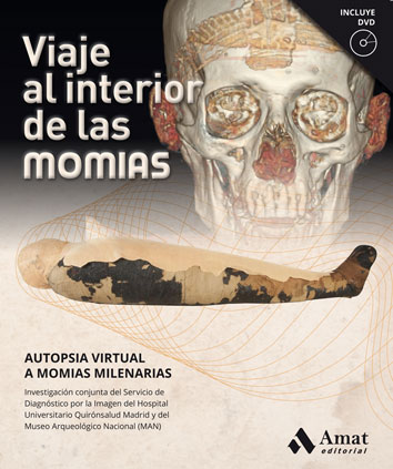 viaje_al_interior_de_las_momias