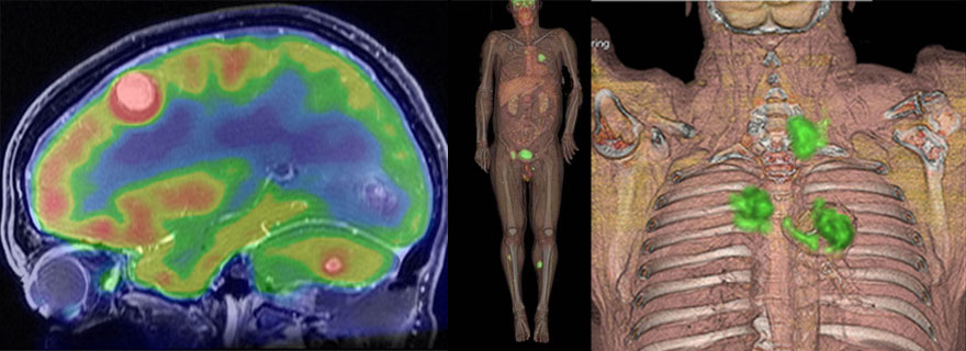nuevo_pet_ct_imagenes_diagnosticas
